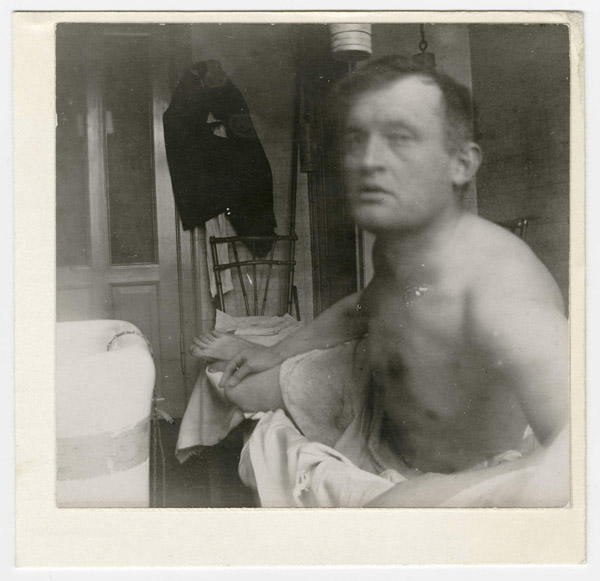 08-edvard-munch-autoportrait-a-la-marat-clinique-jacobson-1908-1909-600x581