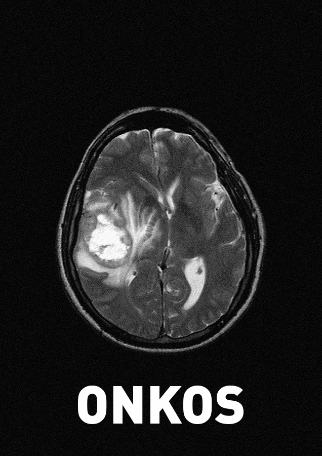 ONKOS_2018
