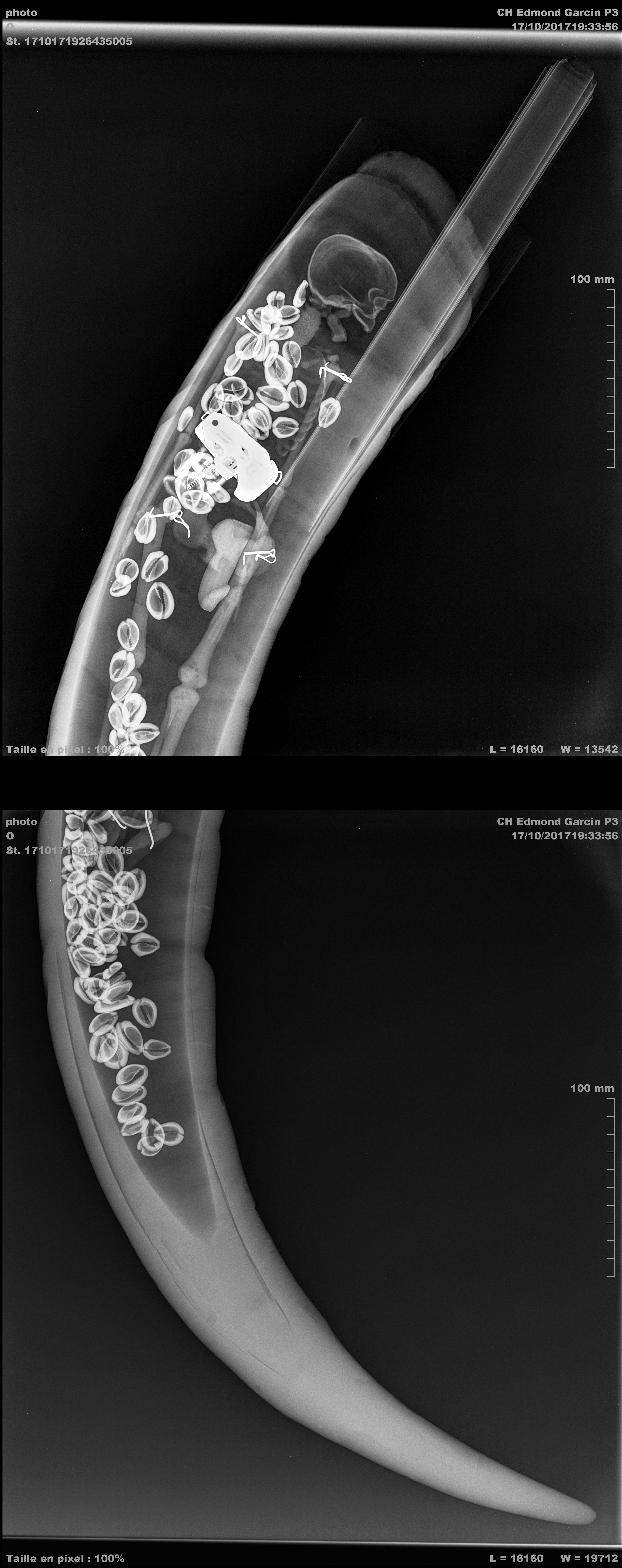 Radiographies cornes